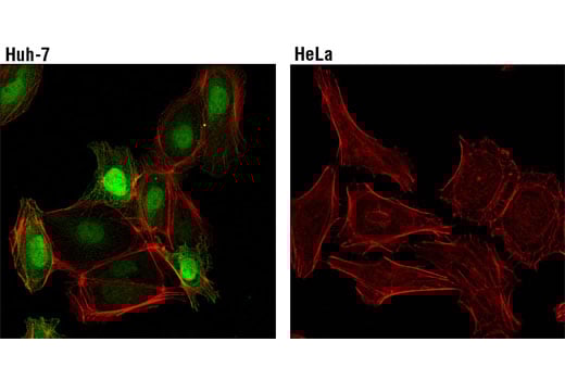 Immunofluorescence Image 1: FABP1 (D2A3X) Rabbit Monoclonal Antibody