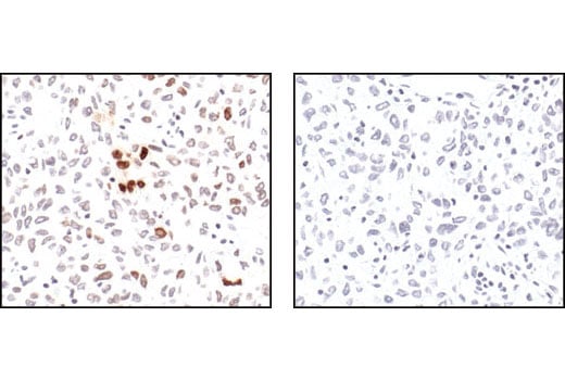 Immunohistochemistry Image 4: Phospho-Histone H2A.X (Ser139) (20E3) Rabbit Monoclonal Antibody (BSA and Azide Free)