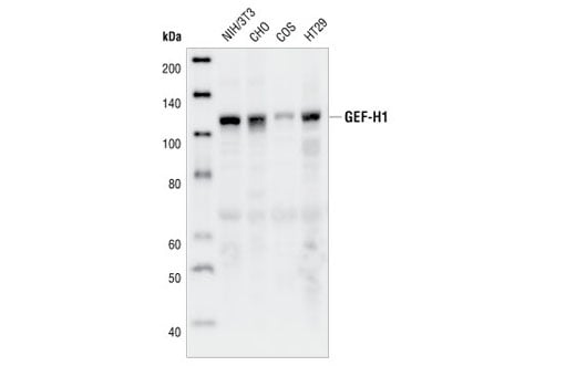 Western Blotting Image 1: GEF-H1 (55B6) Rabbit mAb