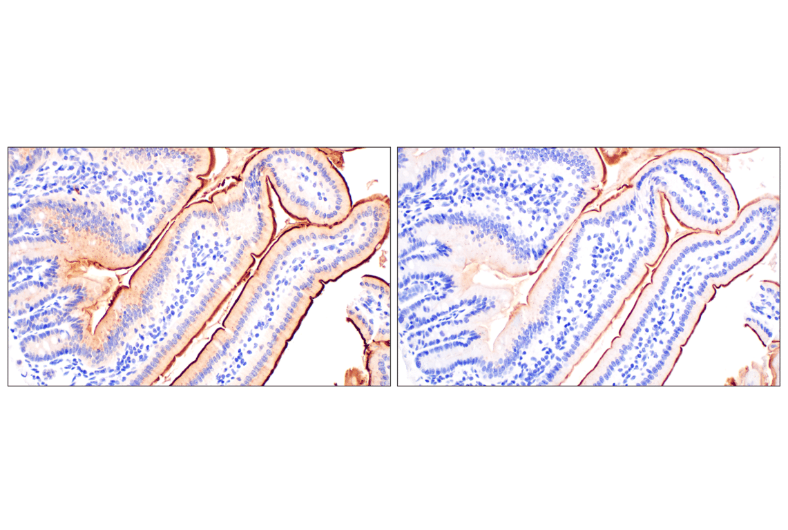 Immunohistochemistry Image 8: CD10/Neprilysin (F4P6H) Rabbit Monoclonal Antibody