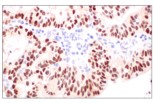 Immunohistochemistry Image 5: p53 (DO-1) Mouse Monoclonal Antibody
