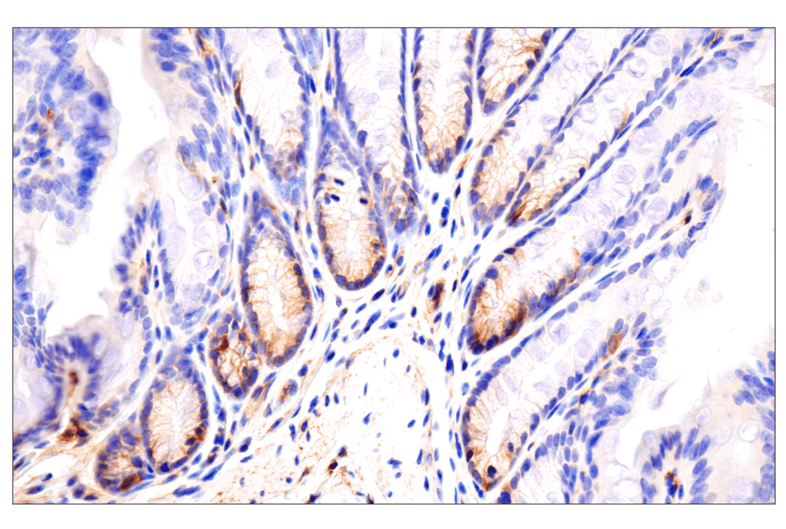 undefined Image 34: Mouse Reactive Exosome Marker Antibody Sampler Kit