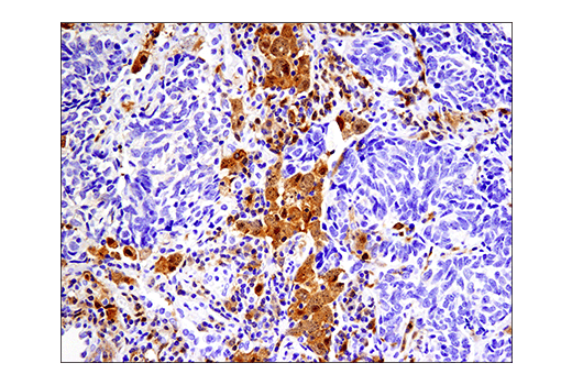 Immunohistochemistry Image 1: IRF-5 (E7F9W) Rabbit Monoclonal Antibody (BSA and Azide Free)