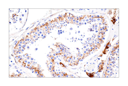 Immunohistochemistry Image 8: Connexin 43 (E7N2R) XP<sup>®</sup> Rabbit mAb (BSA and Azide Free)