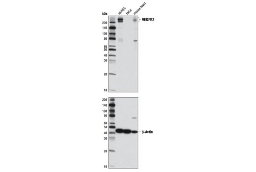 undefined Image 6: Phospho-VEGF Receptor 2 Antibody Sampler Kit