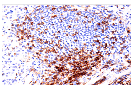 Immunohistochemistry Image 6: CD4 (EP204) Rabbit Monoclonal Antibody
