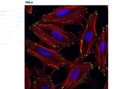 Immunofluorescence Image 1: alpha-Parvin (D7F9) Rabbit Monoclonal Antibody