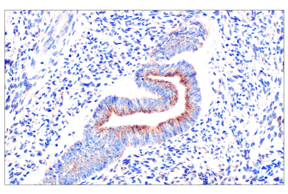 Cathepsin Z (F4M4S) Rabbit Monoclonal Antibody | Cell Signaling