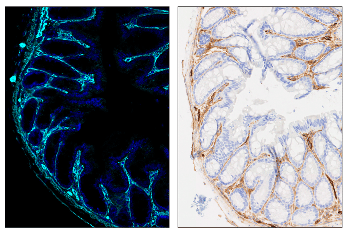 Immunohistochemistry Image 6: CD39/NTPDase 1 (E2X6B) & CO-0076-488 SignalStar<sup>™</sup> Oligo-Antibody Pair