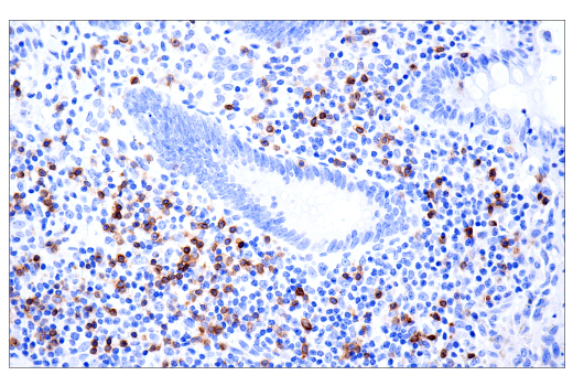Immunohistochemistry Image 1: TRBC1/TCR beta constant region 1 (E6Z3S) Rabbit Monoclonal Antibody