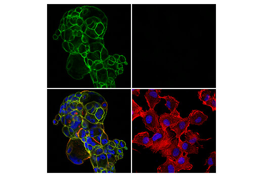 Immunofluorescence Image 1: Insulin Receptor β (E9L5V) XP<sup>®</sup> Rabbit mAb (BSA and Azide Free)