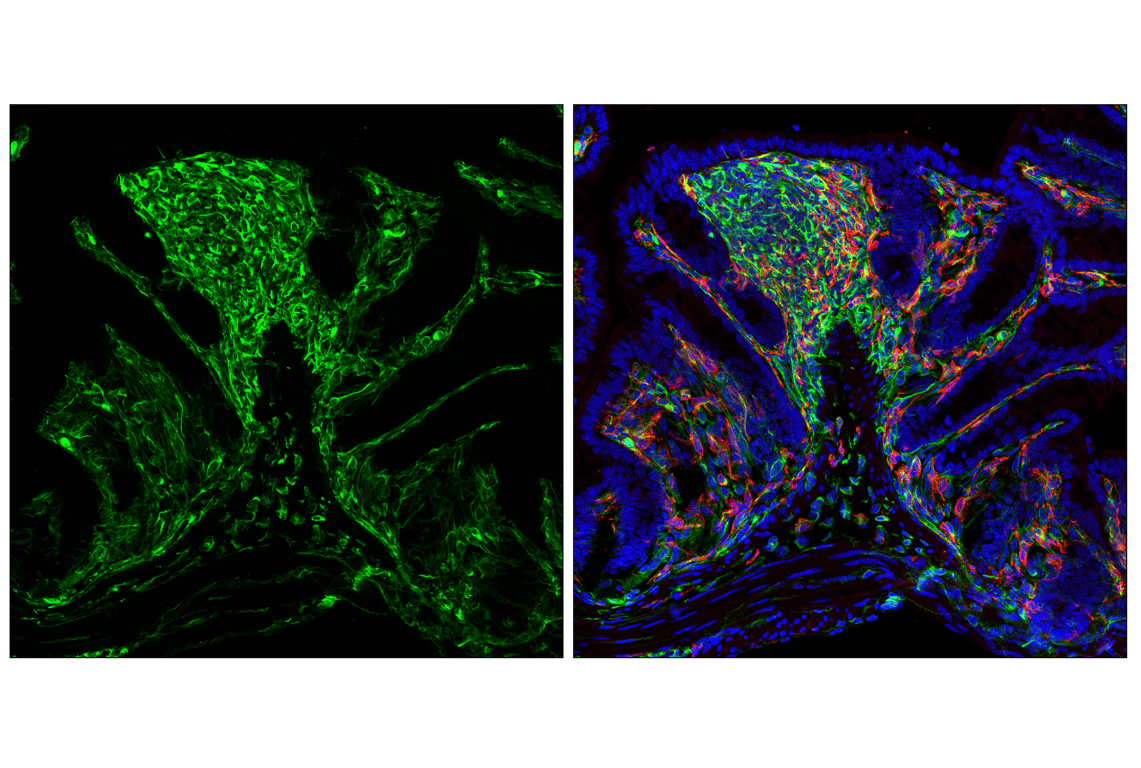 Immunofluorescence Image 3: Vimentin (D21H3) Rabbit Monoclonal Antibody