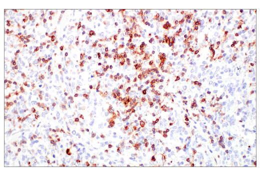 Immunohistochemistry Image 9: CD7 (E4G1Q) Rabbit Monoclonal Antibody (BSA and Azide Free)