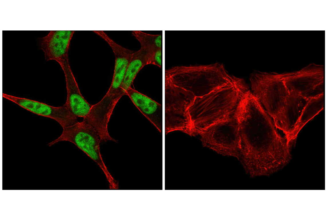 Immunofluorescence Image 1: Androgen Receptor (D6F11) Rabbit Monoclonal Antibody (BSA and Azide Free)