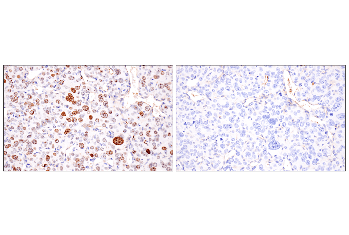 Immunohistochemistry Image 7: Phospho-Histone H2A.X (Ser139) (D7T2V) Mouse Monoclonal Antibody