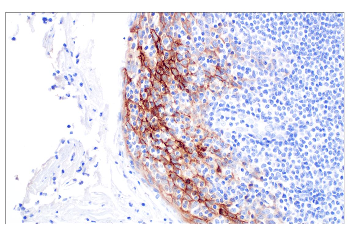 Immunohistochemistry Image 9: CD44 v5 (C44Mab-3) Mouse Monoclonal Antibody
