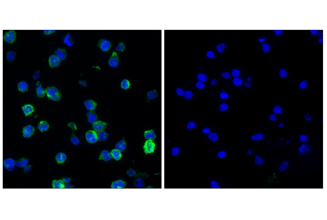 Immunofluorescence Image 1: TREM2 (E4J7A) Rabbit Monoclonal Antibody