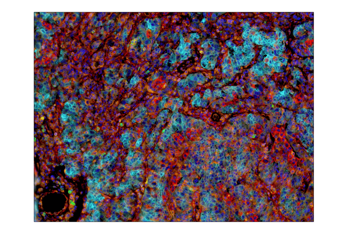 Immunohistochemistry Image 7: VISTA (D1L2G) Rabbit Monoclonal Antibody