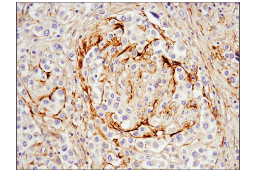 Immunohistochemistry Image 1: MMP-2 (D4M2N) Rabbit Monoclonal Antibody (BSA and Azide Free)