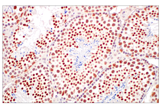 Immunohistochemistry Image 10: TIF1α/TRIM24 (E9T3N) Rabbit mAb