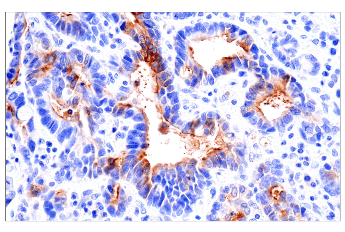 Immunohistochemistry Image 2: CEACAM7 (E5Q6X) Rabbit Monoclonal Antibody