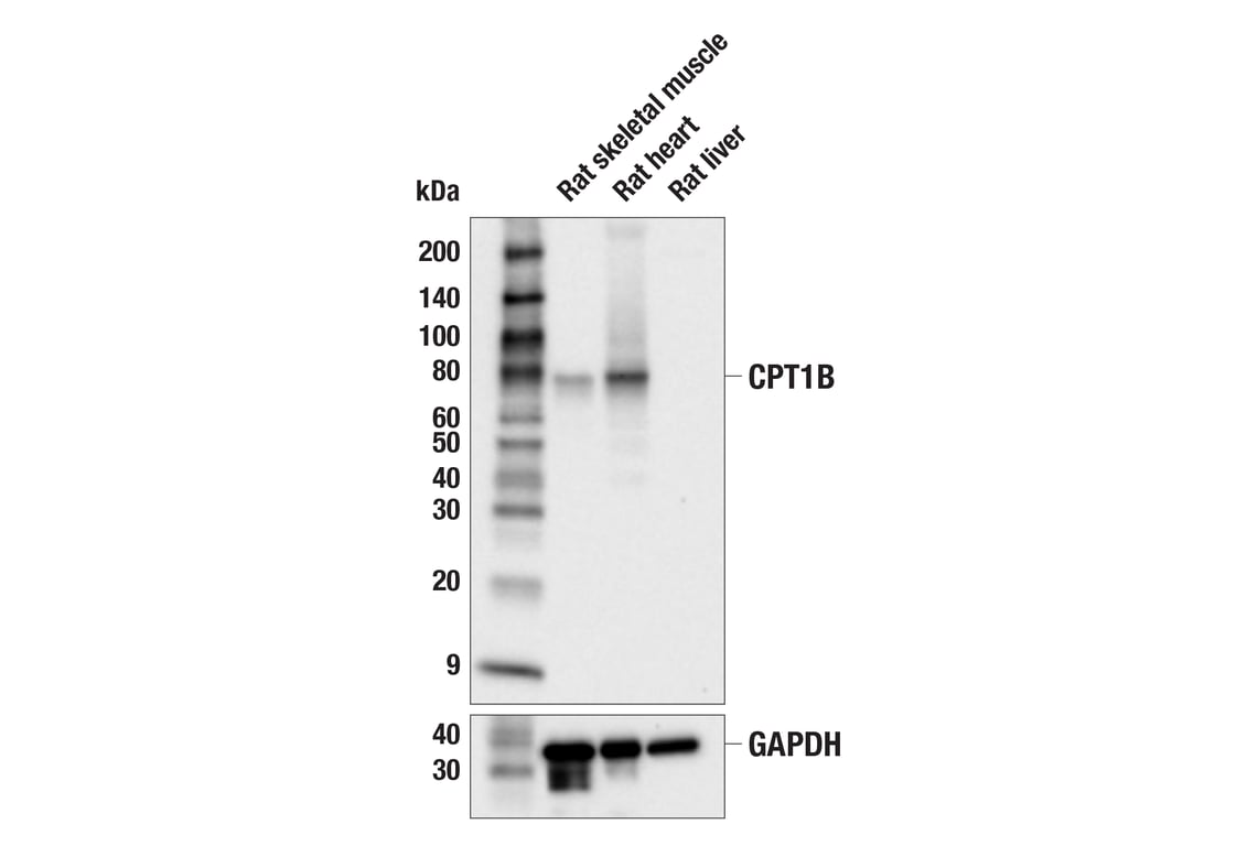 Western Blotting Image 2: CPT1B (E6M5M) Rabbit Monoclonal Antibody