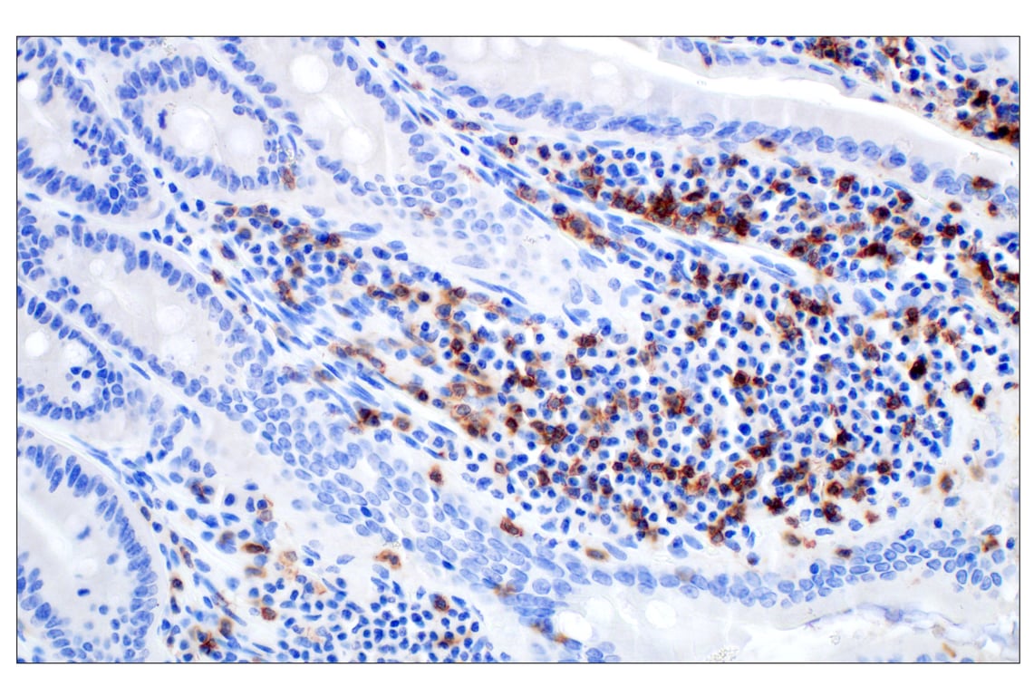 Immunohistochemistry Image 5: CD4 (D7D2Z) Rabbit mAb