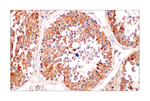 Immunohistochemistry Image 12: CMTM6 (E6A8T) Rabbit Monoclonal Antibody