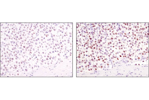 Immunohistochemistry Image 2: Nanog (1E6C4) Mouse Monoclonal Antibody