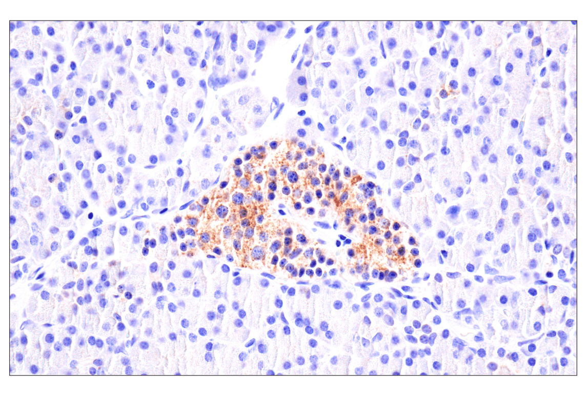 Immunohistochemistry Image 10: AMACR (F7T6V) Rabbit Monoclonal Antibody