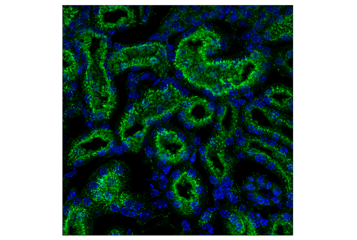 Immunofluorescence Image 1: LAMP2A (F1A5A) Rabbit Monoclonal Antibody