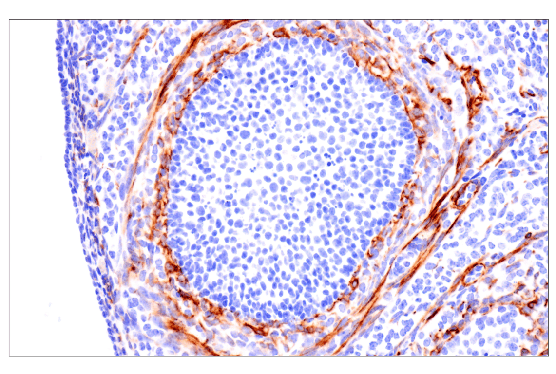 Immunohistochemistry Image 15: Desmin (F5V4I) Rabbit Monoclonal Antibody