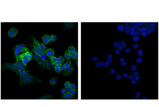 Immunofluorescence Image 1: ROBO2 (E4M6D) Rabbit Monoclonal Antibody