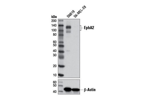 Western Blotting Image 2: EphA2 (8B6) Mouse Monoclonal Antibody