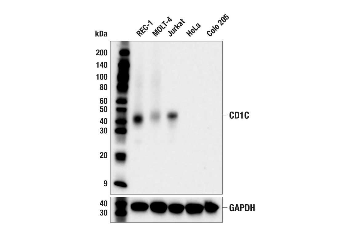 Western Blotting Image 1: CD1C (E6C9A) Mouse mAb