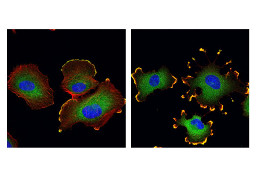 Immunofluorescence Image 1: p130 Cas (E1L9H) Rabbit Monoclonal Antibody (BSA and Azide Free)