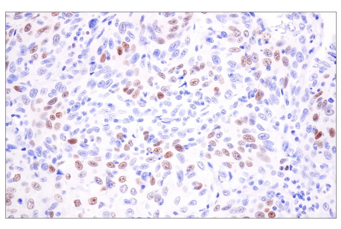 Immunohistochemistry Image 3: TCF1/TCF7 (E6O1K) Rabbit Monoclonal Antibody