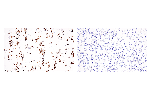 Immunohistochemistry Image 1: SSX (E5A2C) Rabbit Monoclonal Antibody (Carboxy-terminal Antigen)