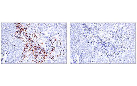 Immunohistochemistry Image 3: LAT (E3U6J) Rabbit Monoclonal Antibody (BSA and Azide Free)