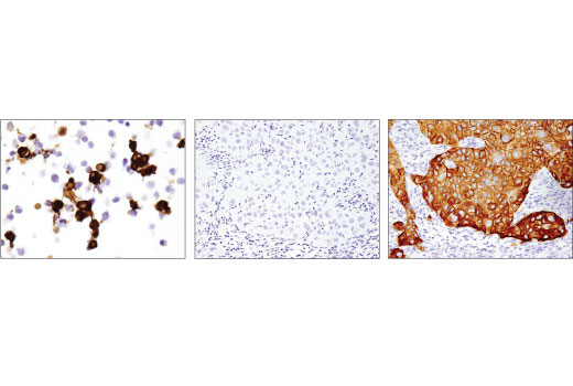 Immunohistochemistry Image 2: EGF Receptor vIII (D6T2Q) Rabbit Monoclonal Antibody (BSA and Azide Free)