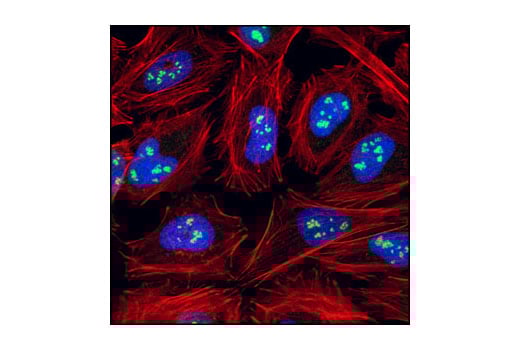 undefined Image 14: Cellular Localization IF Antibody Sampler Kit