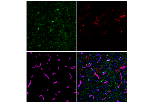 Immunofluorescence Image 2: CMTM6 (E6A8T) Rabbit Monoclonal Antibody