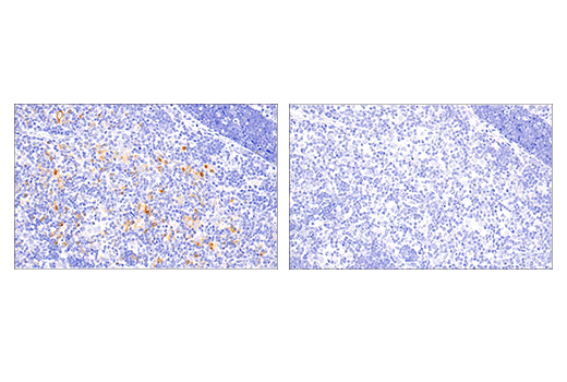 Immunohistochemistry Image 3: 4-1BB/CD137/TNFRSF9 (E2J5H) Rabbit Monoclonal Antibody