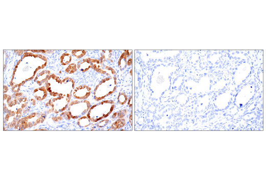 Immunohistochemistry Image 6: NNMT (E6N2Z) Rabbit Monoclonal Antibody