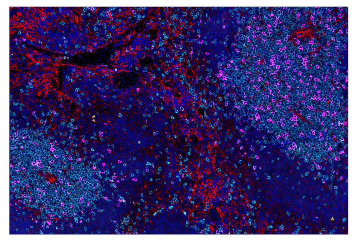 Immunohistochemistry Image 1: IL-2R alpha/CD25 (E9W2J) & CO-0074-594 SignalStar<sup>™</sup> Oligo-Antibody Pair