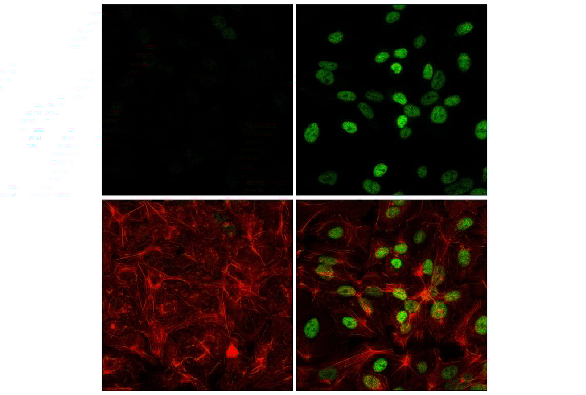 Immunofluorescence Image 1: HIF-1 alpha (E1V6A) Rabbit Monoclonal Antibody (BSA and Azide Free)