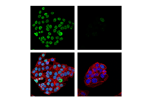 Immunofluorescence Image 1: 53BP1 (E7N5D) Rabbit Monoclonal Antibody (BSA and Azide Free)