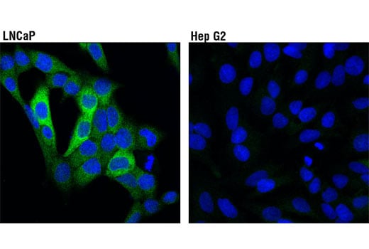 undefined Image 4: PhosphoPlus<sup>®</sup> PFKFB2 (Ser483) Antibody Duet