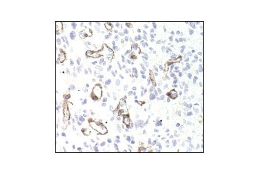 Immunohistochemistry Image 3: PDGF Receptor β (28E1) Rabbit mAb (BSA and Azide Free)