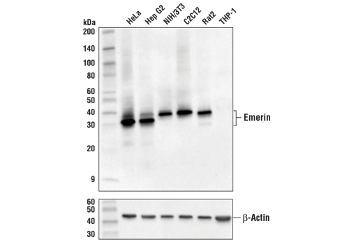 Western Blotting Image 1: Emerin (D3B9G) XP<sup>®</sup> Rabbit mAb